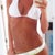 Little bit of scarring in the middle right above bikini bottom - that is where my old belly button was!