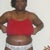 4wks post-op