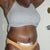 5 wks post-op
