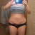 2 months post-op