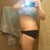 2 months post-op