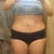 2 months post-op