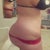 before and wish pics