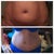 Before pic/ and 7 week po