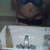 My gallbladder scar is more visible now that the circulation is back keep in mind it WAS wrapped around my Waist and side about 6 inches long,now about a 2 inch line leading from my new belley button I can deal with that.