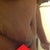 PO Day 15.  Fewer Stretch Marks.  Still tender and swollen