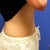 July 2011 - after 2 treatments