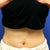 July 2011 - after 2 treatments