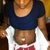 day 1 post op