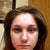 My Right side is really bruised and swollen...