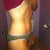 1 year post op!