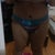 I have dents on my hips which is why I need fat transfer there.