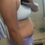 3 weeks 2 days PO - sigh... swollen