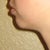 William Bruno, MD answers: Weak jawline - Solutions for a young woman?